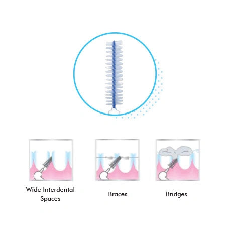 Optimal Interdental Brush (1.0mm)