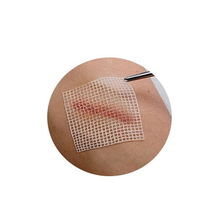 Optimal Sterile Paraffin Gauze (10cm*10cm)