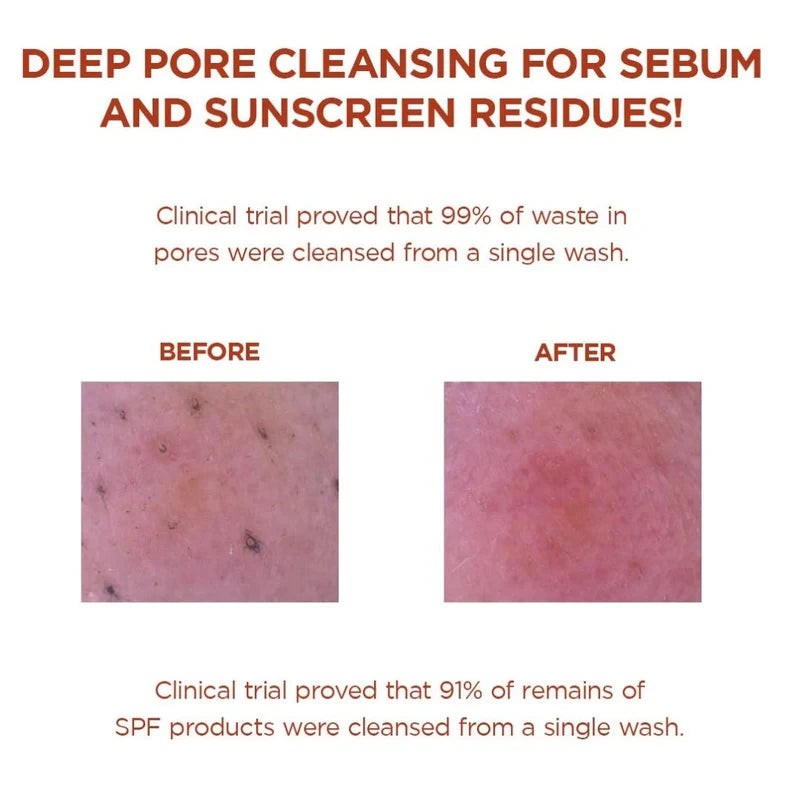 Centella Poremizing Deep Cleansing Foam